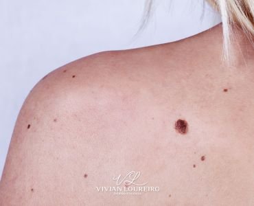 Check-up Dermatológico: o seu está em dia?