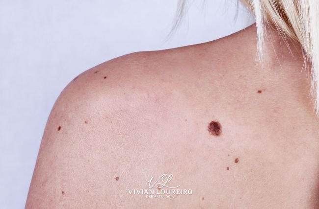 Check-up Dermatológico: o seu está em dia?